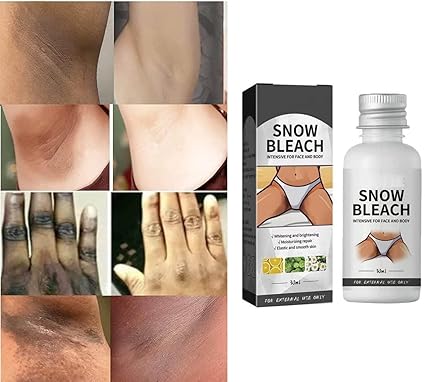 🔥Dark Spot Eraser Cream