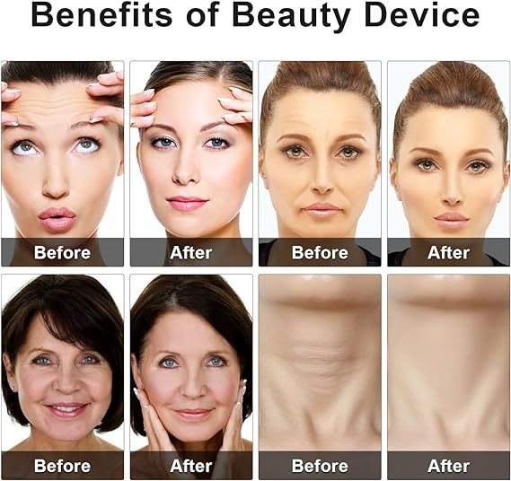 Eye Beauty Device – LED Light & Vibration Eye Massager